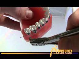 Remember to use the proper connectors when working with wire rope; How To Use The Distal End Cutter Powerprox Six Month Braces Orthodontic Education Video Youtube