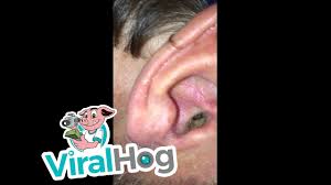 The british tinnitus association says that this action helps to open your eustachian tubes and helps to balance the pressure in your ears. I Have Something In My Ear A Spider Viralhog Youtube