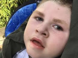 Family of Somerset boy who suffered 'severe and lifelong injuries' at birth  wins legal battle with hospital