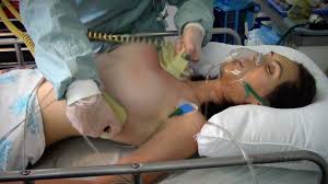 Heart Failure 2 – digital02.com