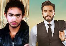 جديد بحث الأغاني علي سمعها. Ø­Øª Ù‰ Ø§Ù„Ù…Ø´Ø§Ù‡ÙŠØ± Ø§Ù„Ø±Ø¬Ø§Ù„ Ø®Ø¶Ø¹ÙˆØ§ Ù„Ø¹Ù…Ù„ÙŠØ§Øª ØªØ¬Ù…ÙŠÙ„ ÙˆØªØºÙŠ Ø±Øª Ù…Ù„Ø§Ù…Ø­Ù‡Ù… Ù…Ù†