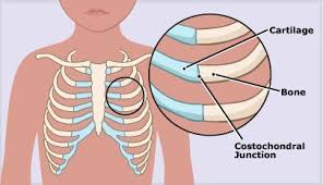 Pin On Homeopathy Muscle Joint Pain