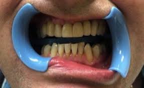 Give us a call 09 520 6223. Dental Services