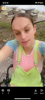 amputee struggles with physical therapy