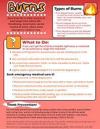 Burns Instruction Sheet First Aid Information Basic First Aid First Aid For Kids