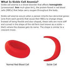 Hemoglobin ss disease, sickle cell anemia. Sickle Cell Anemia V1 Perfusion Com