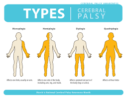 everyday ableism on types of cerebral palsy cerebral