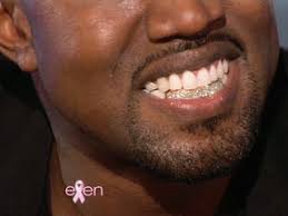 We should call this the gold standard or maybe the diamond standard of teeth bling. Did Kanye West Really Have His Teeth Pulled Out And Replaced With Diamonds An Expert Weighs In Ew Com