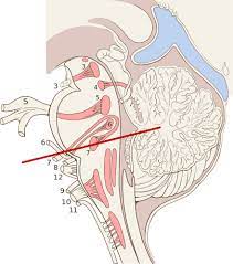 Cerebellar nuclei / anatomy & histology*. Brainstem Wikiwand