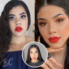 De wikipedia, la enciclopedia libre. Yucatan Avisa Yucatanavisa Kenia Os Cuantas Cirugias Lleva En Su Lista Fue Expuesta Belleza Creada Es Una Popular Cuenta Encargada De Exponer A Los Famosos Cuando De Cirugias Esteticas O
