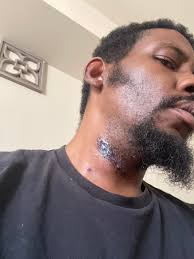 A professional wrestling bump has the same effect