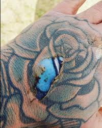 Hand tattoos are often the obvious choice of people having their first tattoos. Burn Mark On Hand Reveiles Fresh Tattoo Mildlyinteresting