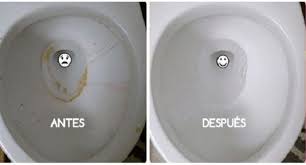 Image result for sanita