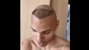 Schmeichel, højbjerg og braithwaite reagerer på eriksen situationen. Braithwaite S New Hairstyle Has Everyone Compare Him To Ronaldo Nazario Ghana Latest Football News Live Scores Results Ghanasoccernet