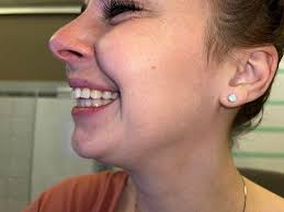 Brigham Orthodontics, 9301 E Shea Blvd, Ste 111, Scottsdale, AZ 85260, US