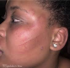 Hello admins My boyfriend attacked me and broke my phone because i went to  The club without him. What should i do to him because i love him so much i  dont