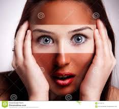 Brulé sur le visage, et coups de soleil sur les bras, le cou et la tete. Concept De Coup De Soleil Femme Avec La Moitie Finie Bronzage Du Visage Image Stock Image Du Peau Femme 59742579