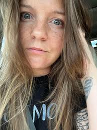 Unfiltered photo with zits to prove 3 years sober