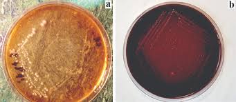 „shigellosis is endemic throughout the world where it is held responsible for some 120 million cases of severe dysentery with blood and mucus in the stools, the overwhelming. Article Fulle Text