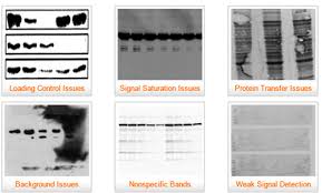 Maybe you would like to learn more about one of these? Solved Your Three Most Common Western Blotting Problems