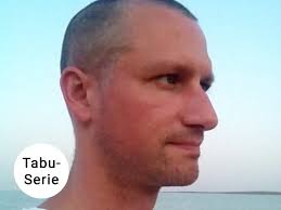 Tabu-Serie: Schuppenflechte