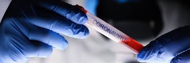Tagespendler aus einfachen risikogebieten haben die folgenden pflichten: Corona Tests Kostenfrei Fur Alle Reiseruckkehrer Seit Samstag Medi Sudwest E V
