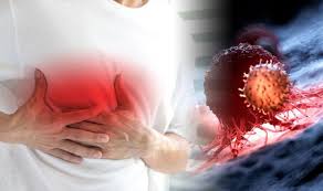 This is called a deep vein thrombosis or dvt. Breast Cancer Symptoms Yes Men Can Get It Too Here Are The Signs To Look Out For Sound Health And Lasting Wealth
