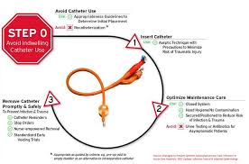 Image result for Urethral Catheterization