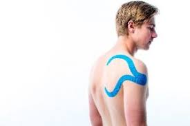 Medical Taping Bei Einem Impingement Syndrom Der Schulter Physiotape