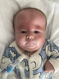 Praying for Jesse's lung pressures to even out today