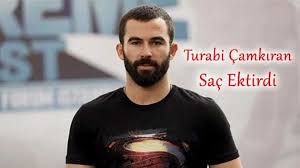 Turabi Camkiran Sac Ektirdi Sac