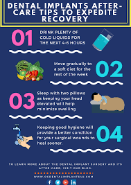 Abiding Wisdom Teeth Aftermath Dentistday Blackdentalhygienist Dental Implants Dental Implant Surgery Dental