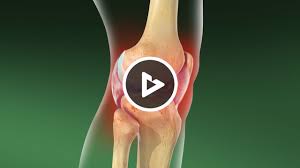 Image result for Septic Joint