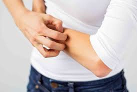 Neurodermitis Nesselsucht Exzem Hypnose Limmattal