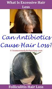 Pin On Hair Growth