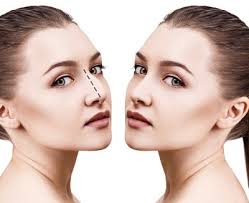 Rhinoplasty Norman OK