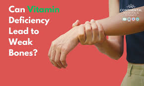Image result for Vitamin Deficiency