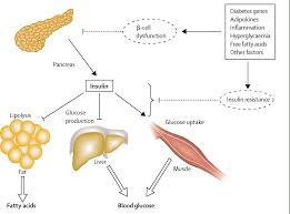 Type 2 Diabetes Principles Of Pathogenesis And Therapy The Lancet