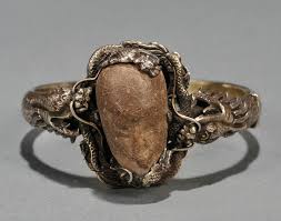 Bezoar Wikipedia The Free Encyclopedia Crystals And Gemstones Stones And Crystals Gallbladder Stones