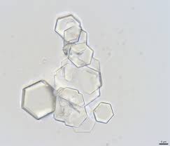 Nephrolithiasis Amboss