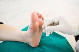 Assessment of Diabetic Foot Ulcers | WoundSource