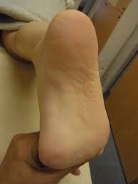 足の裏の筋肉を、 : 林足研究所 足&外反母趾 修正&日常の日記