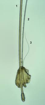 Anagen is the hair growing phase. Hair Follicle Miniaturization And Intermediate Hairs As Terminal Hair Download Scientific Diagram