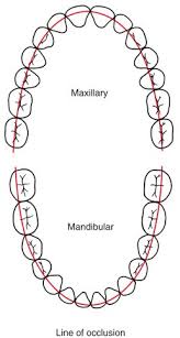 | meaning, pronunciation, translations and examples. Malocclusion And Dentofacial Deformity In Contemporary Society Pocket Dentistry