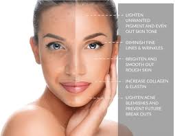 It reduces stretch marks, wrinkles, and large pores. Chemical Peels For A Smoother Less Wrinkled Neck Face And Hands In Issaquah And Bellevue Vivaa Seattle Wa