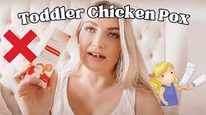 Toddler With Chicken Pox