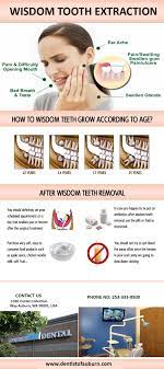 Scandalous Dental Care Tips Heal Cavities Toothfairyiscoming Toothimplant Wisdom Tooth Extraction Wisdom Teeth Removal Wisdom Teeth