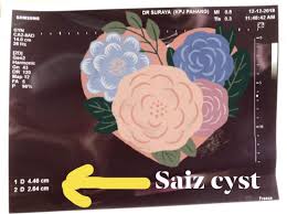 Itulah mengapa bruntusan kerap dialami bayi. I Am Saljuputih Allah Swt Sentiasa Bersama Ku