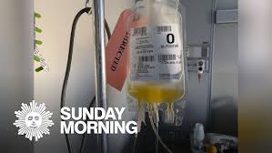 Image result for Plasma Transfusion