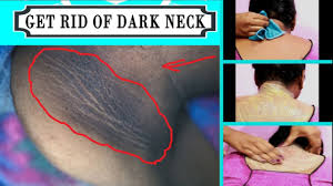 Dehydration can quickly make smooth skin look dry and crepey instead. How To Get Rid Of Dark Neck Fast And Easy Natural Remedy Brown Skin Around Neck Youtube